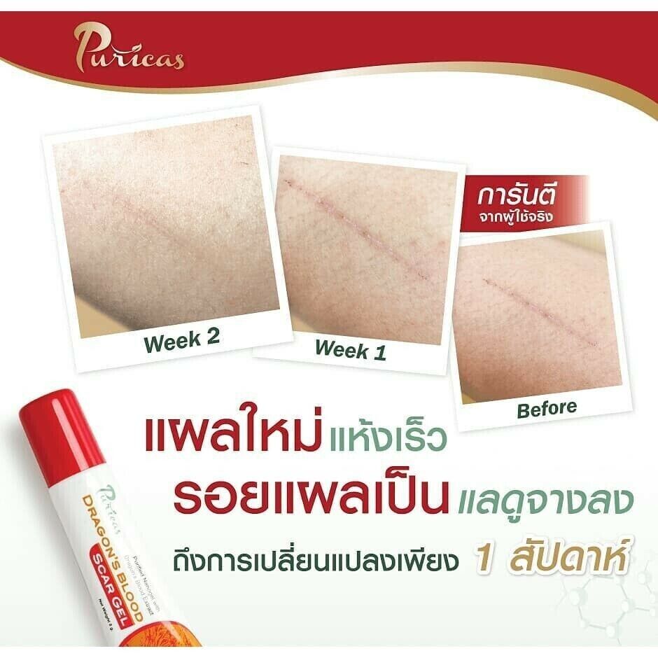 20 g Puricas Dragon's Blood Scar Gel Treat Keloid Surgery Acne Scars Dark spots
