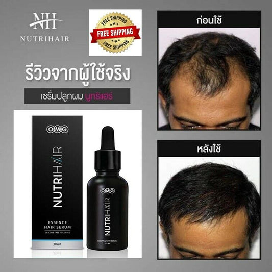 NUTRIHAIR SERUM Regrowth Essence Growth Strong Hair Loss Treatments